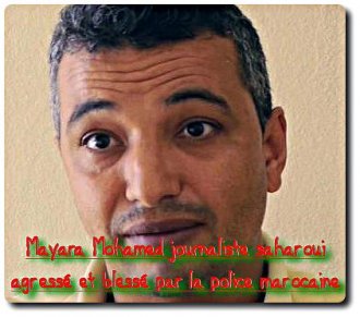 Agressé par la police marocaine, le juste combat du journaliste sahraoui Mohamed Mayara – POPULI-SCOOP : Info citoyenne & Actu critique Agressé par la police marocaine, le juste combat du journaliste sahraoui Mohamed Mayara – POPULI-SCOOP : Info citoyenne & Actu critique