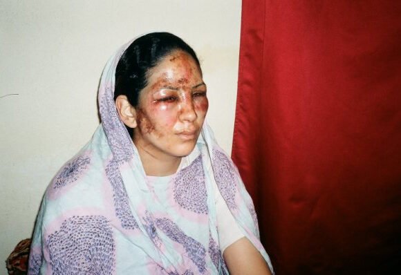 Día Internacional de los Derechos Humanos: La pandemia ha agravado las violaciones de los DDHH en el Sáhara Occidental