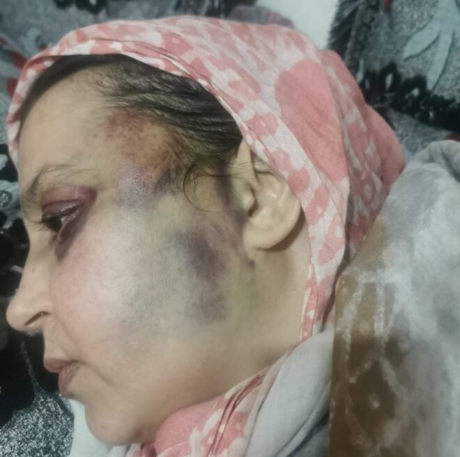 Agosto saharaui: No hay derechos humanos para Sultana Jaya | Contramutis