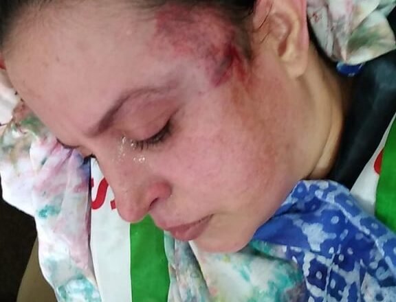 LLAMAMIENTO URGENTE PARA PROTEGER A LA POBLACION CIVIL SAHARAUI EN LAS ZONAS OCUPADAS DEL SAHARA OCCIDENTAL – Delegación del Frente Polisario para España