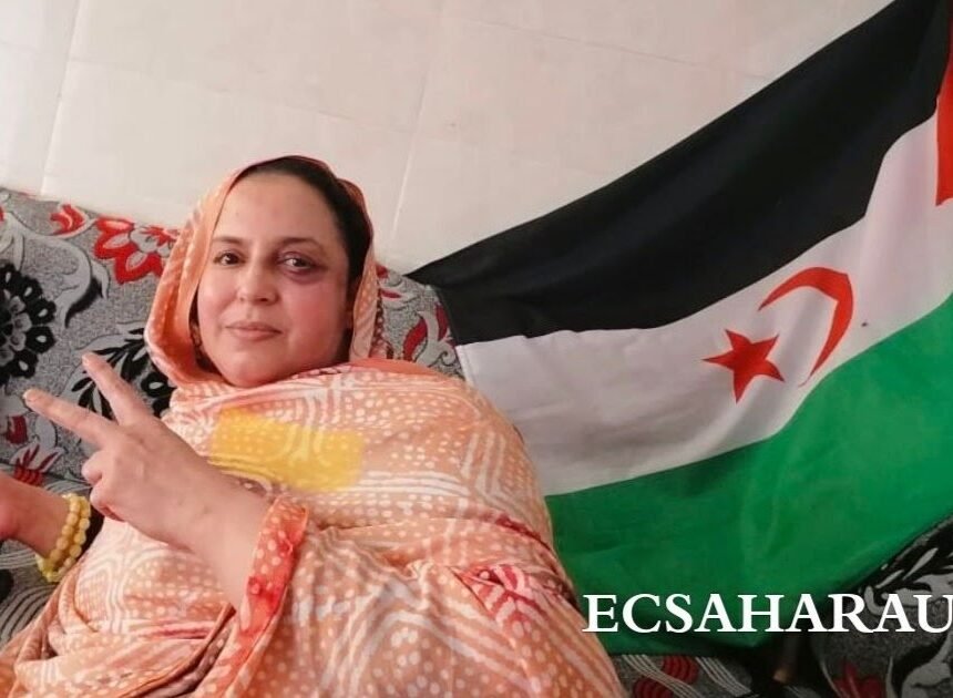 Nueva agresión de las fuerzas de ocupación marroquís contra Sultana Jaya, esta vez le rociaron ácido tóxico en la cara