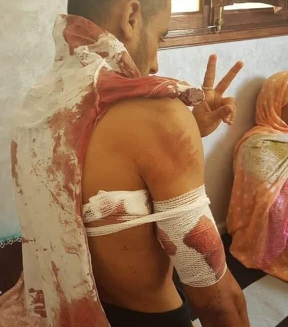 Día Internacional en Apoyo de las Víctimas de la Tortura: Marruecos tortura y asesina a menores saharauis con absoluta impunidad por su pensamiento político