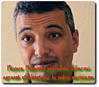 Agressé par la police marocaine, le juste combat du journaliste sahraoui Mohamed Mayara – POPULI-SCOOP : Info citoyenne & Actu critique