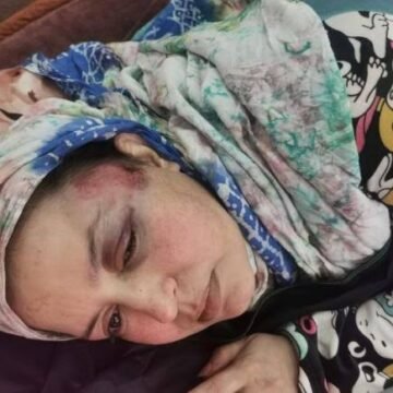 ONG saharaui condena los crímenes de las fuerzas de ocupación marroquí contra la activista Sultana Sidbrahim Jaya y su familia | Sahara Press Service