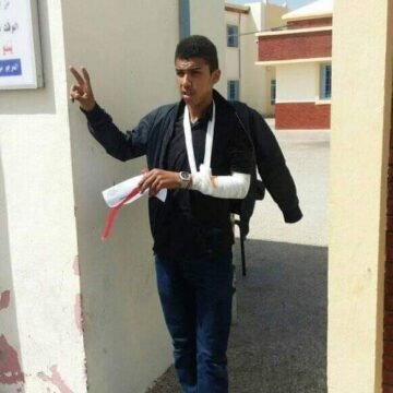 Moroccan forces use violence against Sahrawi pupil | Sahara Press Service