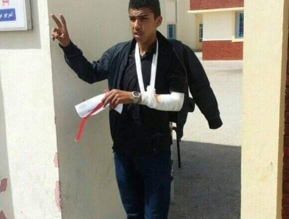 index_7 Moroccan forces use violence against Sahrawi pupil | Sahara Press Service