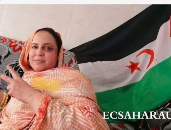 Las fuerzas marroquíes asaltan de nuevo la casa de Sultana Jaya y agreden a miembros de su familia