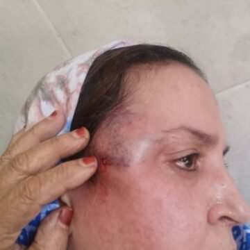 Saltana Jaya afirma que el ocupante marroquí ejerce una represión feroz e indiscriminada jamás vista contra los civiles saharauis | Sahara Press Service