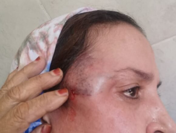 Saltana Jaya afirma que el ocupante marroquí ejerce una represión feroz e indiscriminada jamás vista contra los civiles saharauis | Sahara Press Service