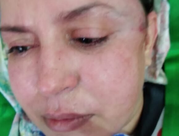 L’occupant marocain a empêché une délégation américaine de rendre visite à Sultana Khaya | Sahara Press Service