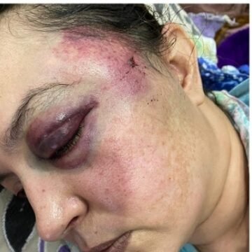 La militante sahraouie Soltana Khaya plus que jamais disposée à poursuivre la lutte | Sahara Press Service