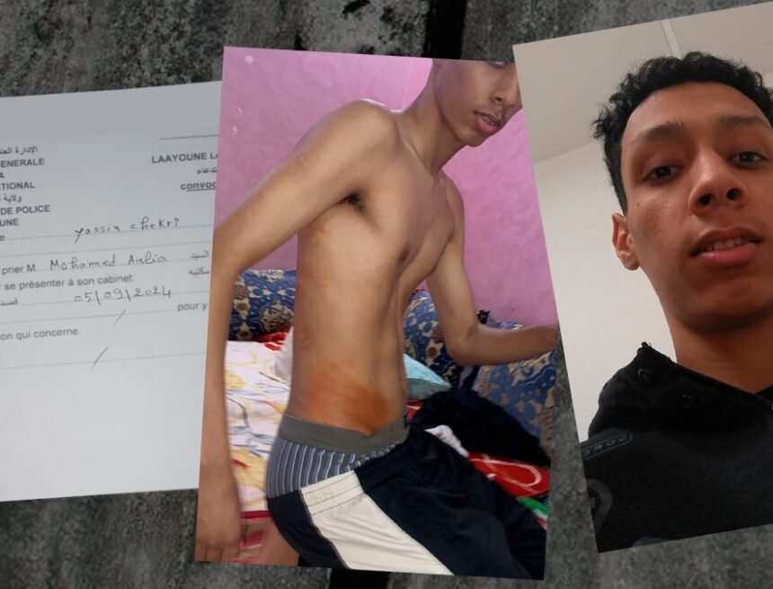 DEPORTACIONES ACTIVISTAS SAHARAUIS | El saharaui que cuestiona a Marlaska: “En Marruecos me matarán»