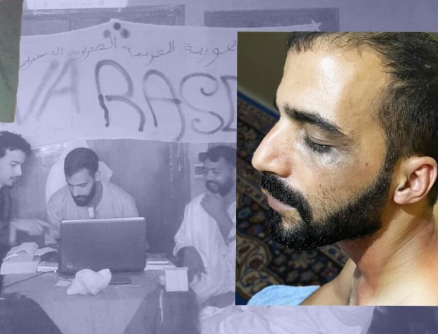 DEPORTACIONES ACTIVISTAS SAHARAUIS | El saharaui torturado por Marruecos al que Marlaska deniega asilo