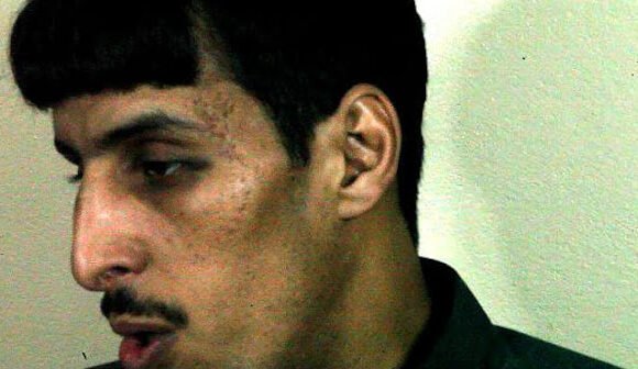 AFAPREDESA: El joven saharaui Breika Bahi brutalmente agredido por las fuerzas de ocupación marroquíes