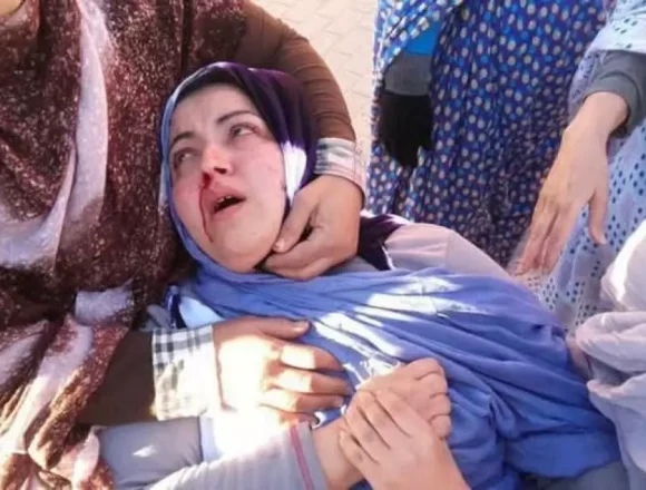 1000422122 SAHARA OCCIDENTAL | La agresión a dos activistas saharauis deja al descubierto la brutalidad de las fuerzas de ocupación marroquí – Resumen Latinoamericano